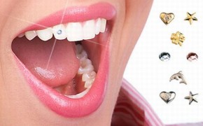 Украшение зубов