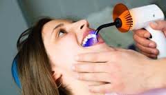 Лечим зубы при помощи лазера